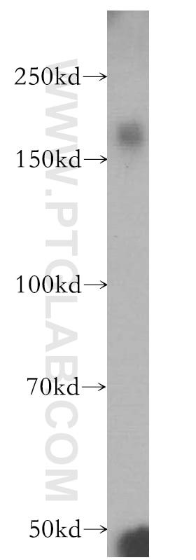 Western Blot (WB) analysis of human brain tissue using ZCCHC11 Polyclonal antibody (18980-1-AP)