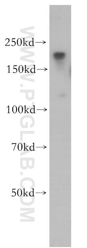 Western Blot (WB) analysis of MCF-7 cells using ZCCHC11 Polyclonal antibody (18980-1-AP)