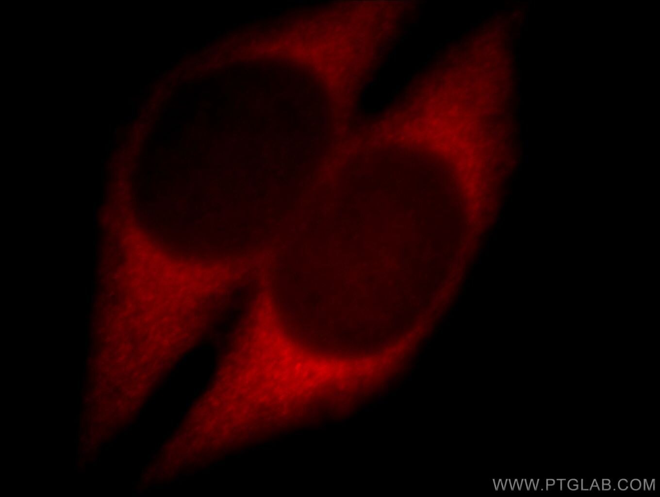 Immunofluorescence (IF) / fluorescent staining of HeLa cells using ZCCHC11 Polyclonal antibody (20119-1-AP)