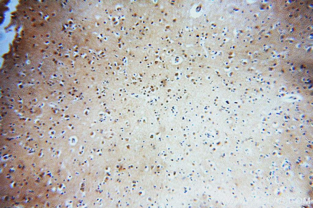 Immunohistochemistry (IHC) staining of human brain tissue using ZCCHC11 Polyclonal antibody (20119-1-AP)