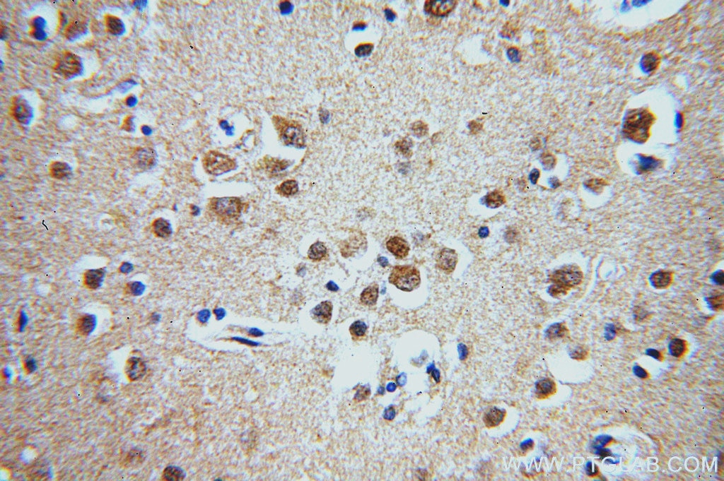 Immunohistochemistry (IHC) staining of human brain tissue using ZCCHC11 Polyclonal antibody (20119-1-AP)