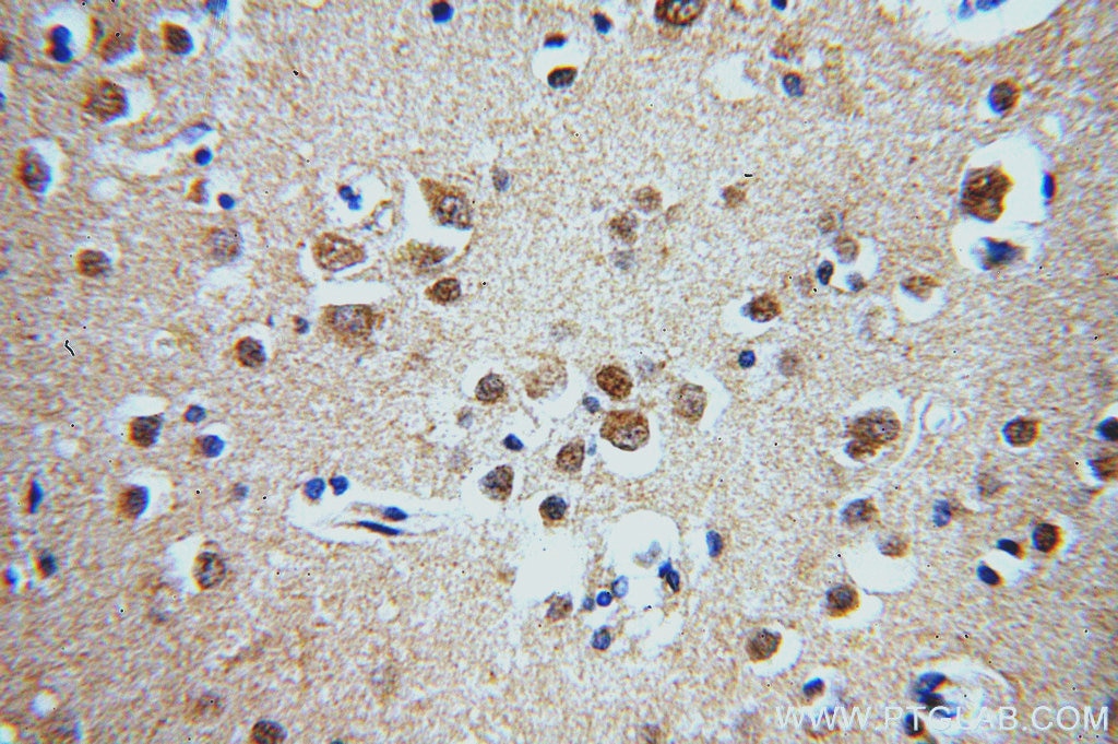 IHC staining of human brain using 20119-1-AP