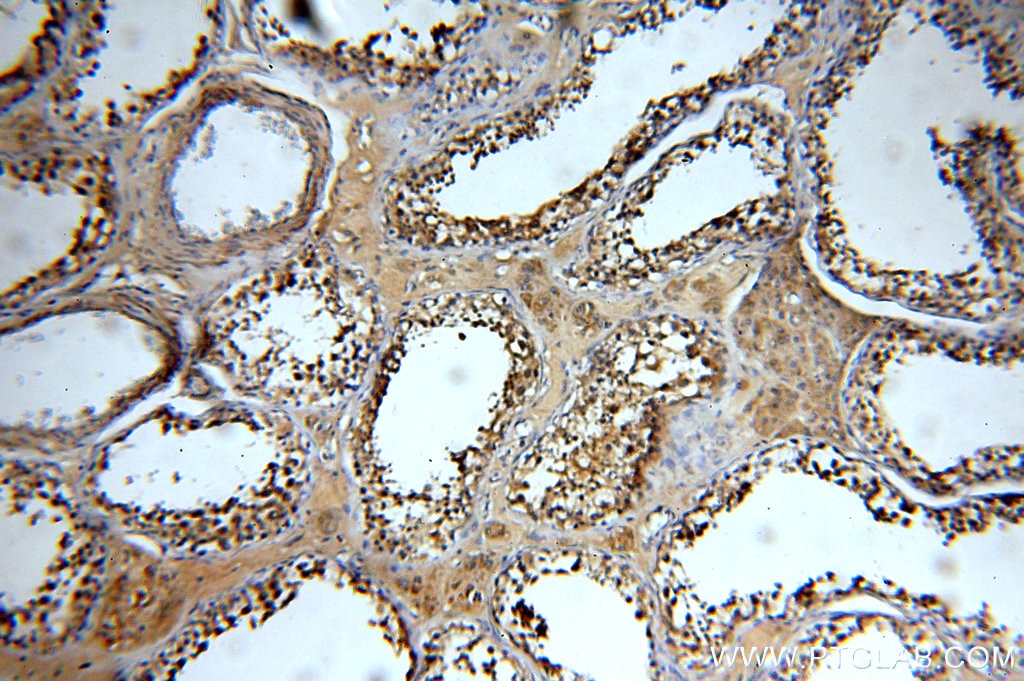 Immunohistochemistry (IHC) staining of human testis tissue using ZCCHC11 Polyclonal antibody (20119-1-AP)