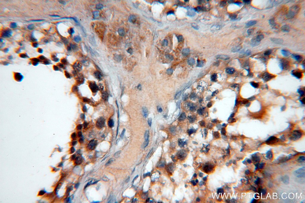 IHC staining of human testis using 20119-1-AP