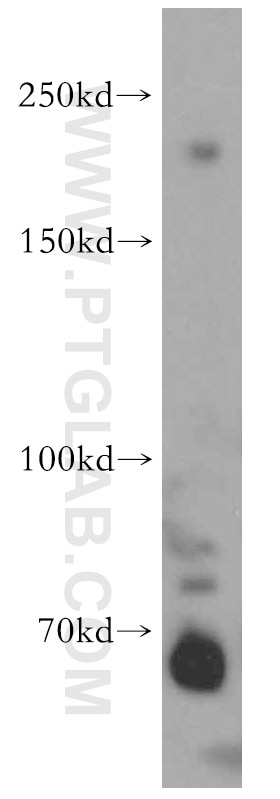 Western Blot (WB) analysis of HeLa cells using ZCCHC11 Polyclonal antibody (20119-1-AP)