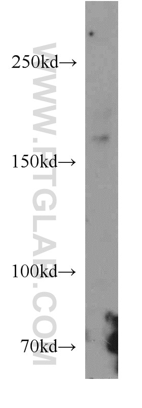 Western Blot (WB) analysis of human brain tissue using ZCCHC11 Polyclonal antibody (20119-1-AP)