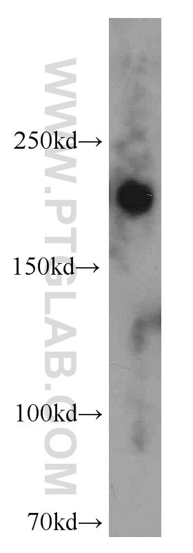 Western Blot (WB) analysis of HeLa cells using ZCCHC11 Polyclonal antibody (20119-1-AP)