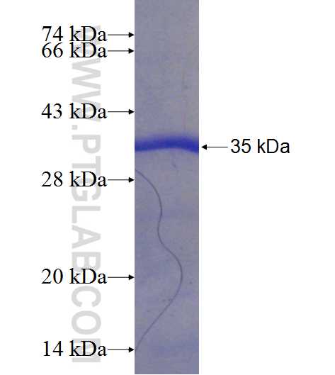 ZCCHC12 fusion protein Ag23848 SDS-PAGE