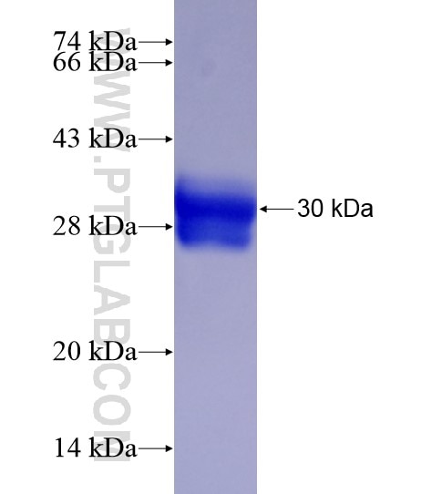 ZCCHC13 fusion protein Ag22050 SDS-PAGE