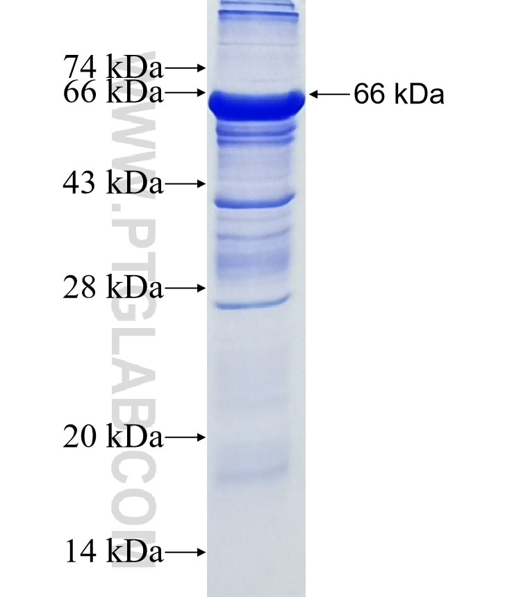 ZCCHC14 fusion protein Ag18792 SDS-PAGE