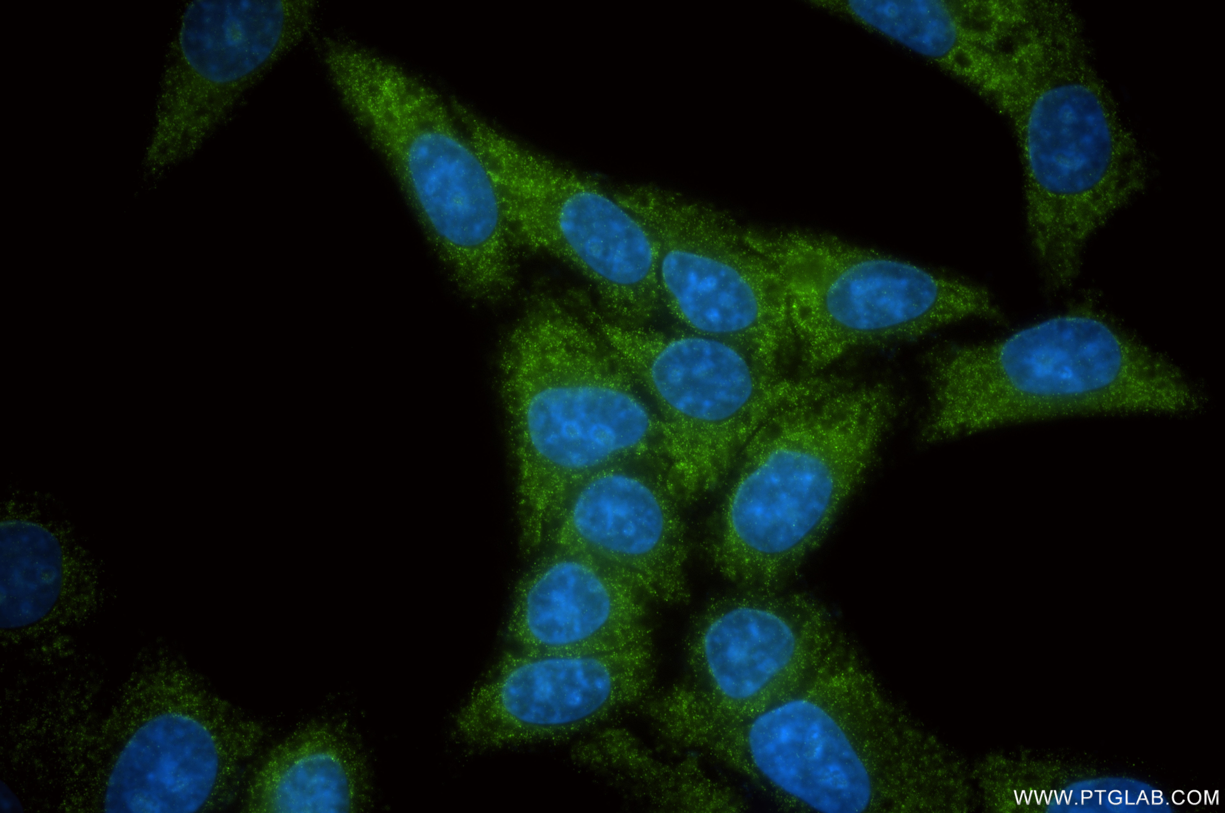 Immunofluorescent analysis of (-20°C Ethanol) fixed HepG2 cells using ZCCHC3 antibody (85721-3-RR, Clone: 250088G1 ) at dilution of 1:200 and CoraLite®488-Conjugated Goat Anti-Rabbit IgG(H+L) (SA00013-2). This data was developed using the same antibody clone with 85721-3-PBS in a different storage buffer formulation. Immunofluorescence (IF) / fluorescent staining of HepG2 cells using ZCCHC3 Recombinant monoclonal antibody (85721-3-RR)
