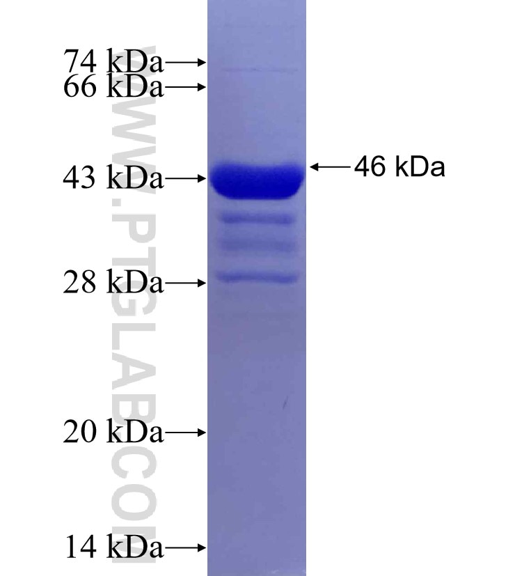 ZCCHC3 fusion protein Ag30047 SDS-PAGE