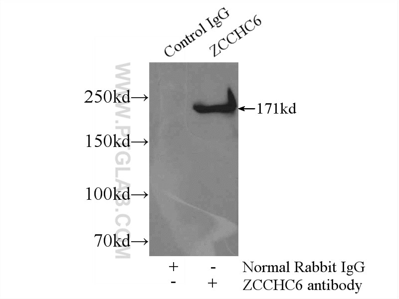 Immunoprecipitation (IP) experiment of HeLa cells using ZCCHC6 Polyclonal antibody (25196-1-AP)