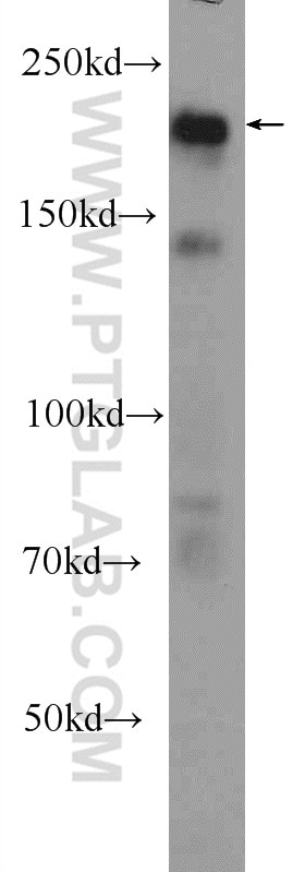 Western Blot (WB) analysis of HeLa cells using ZCCHC6 Polyclonal antibody (25196-1-AP)