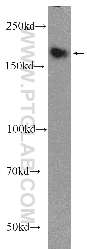 WB analysis of PC-3 using 25196-1-AP