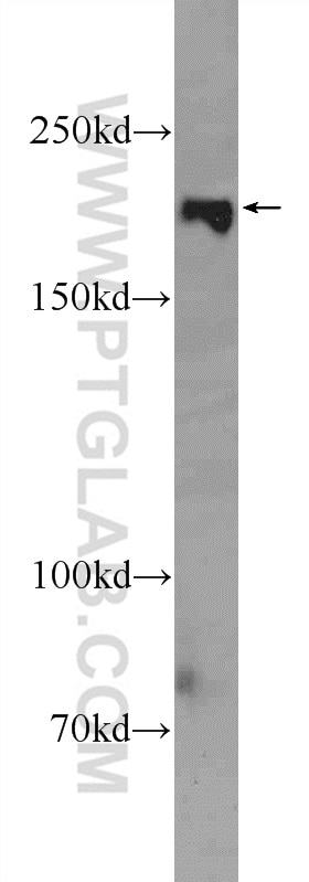 Western Blot (WB) analysis of MCF-7 cells using ZCCHC6 Polyclonal antibody (25196-1-AP)