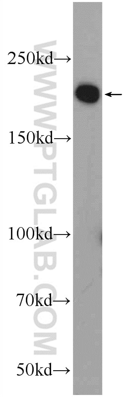 Western Blot (WB) analysis of mouse brain tissue using ZCCHC6 Polyclonal antibody (25196-1-AP)