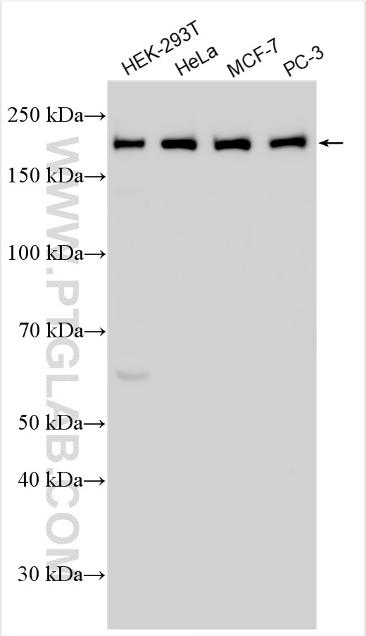 Western Blot (WB) analysis of various lysates using ZCCHC6 Polyclonal antibody (25196-1-AP)