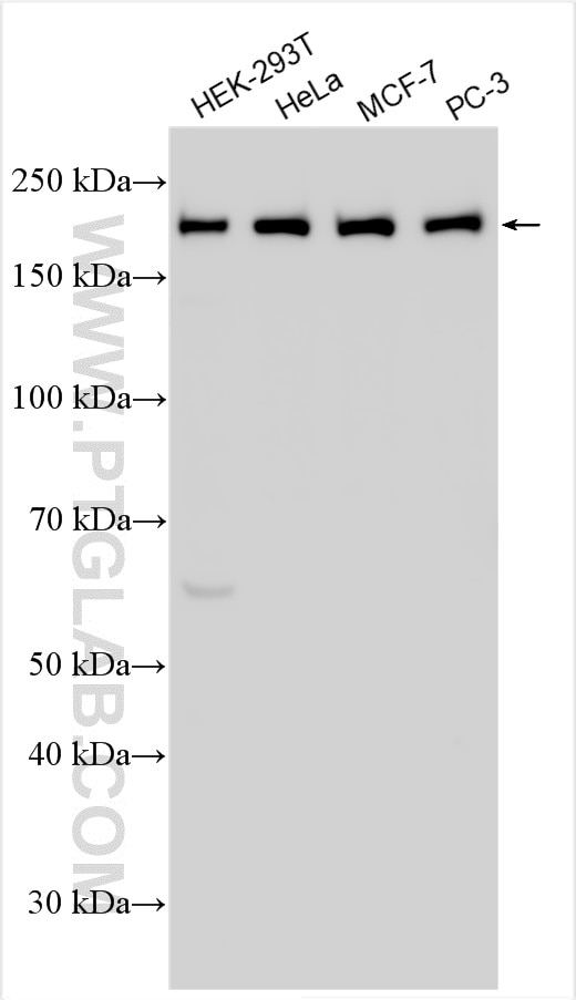 Western Blot (WB) analysis of various lysates using ZCCHC6 Polyclonal antibody (25196-1-AP)