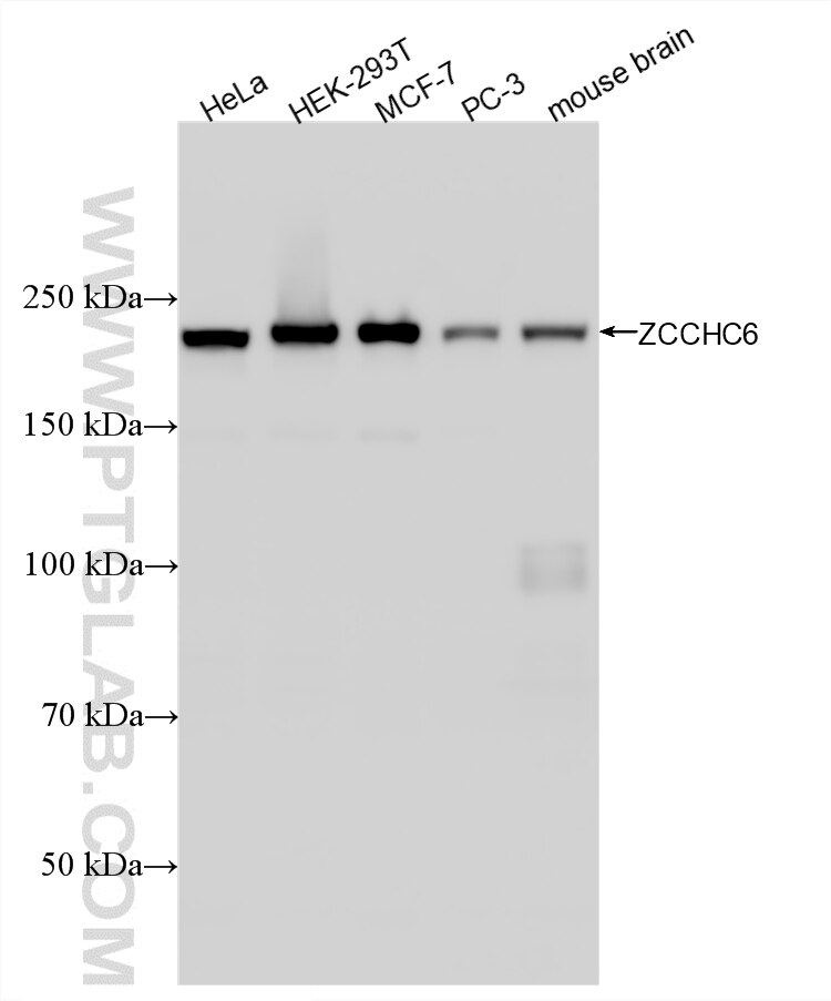 WB analysis using 88391-1-RR Western Blot (WB) analysis of various lysates using ZCCHC6 Recombinant monoclonal antibody (88391-1-RR)