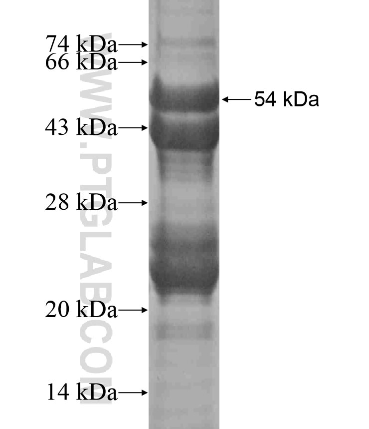 ZCCHC6 fusion protein Ag18240 SDS-PAGE