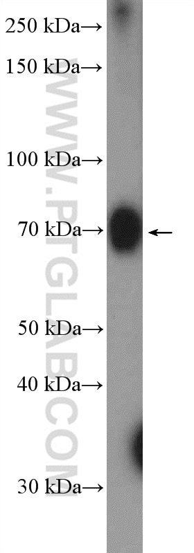Western Blot (WB) analysis of HeLa cells using ZCCHC7 Polyclonal antibody (22412-1-AP)