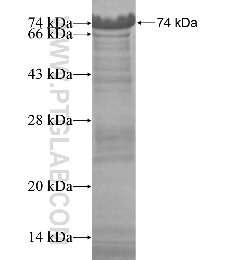 ZCCHC7 fusion protein Ag18119 SDS-PAGE