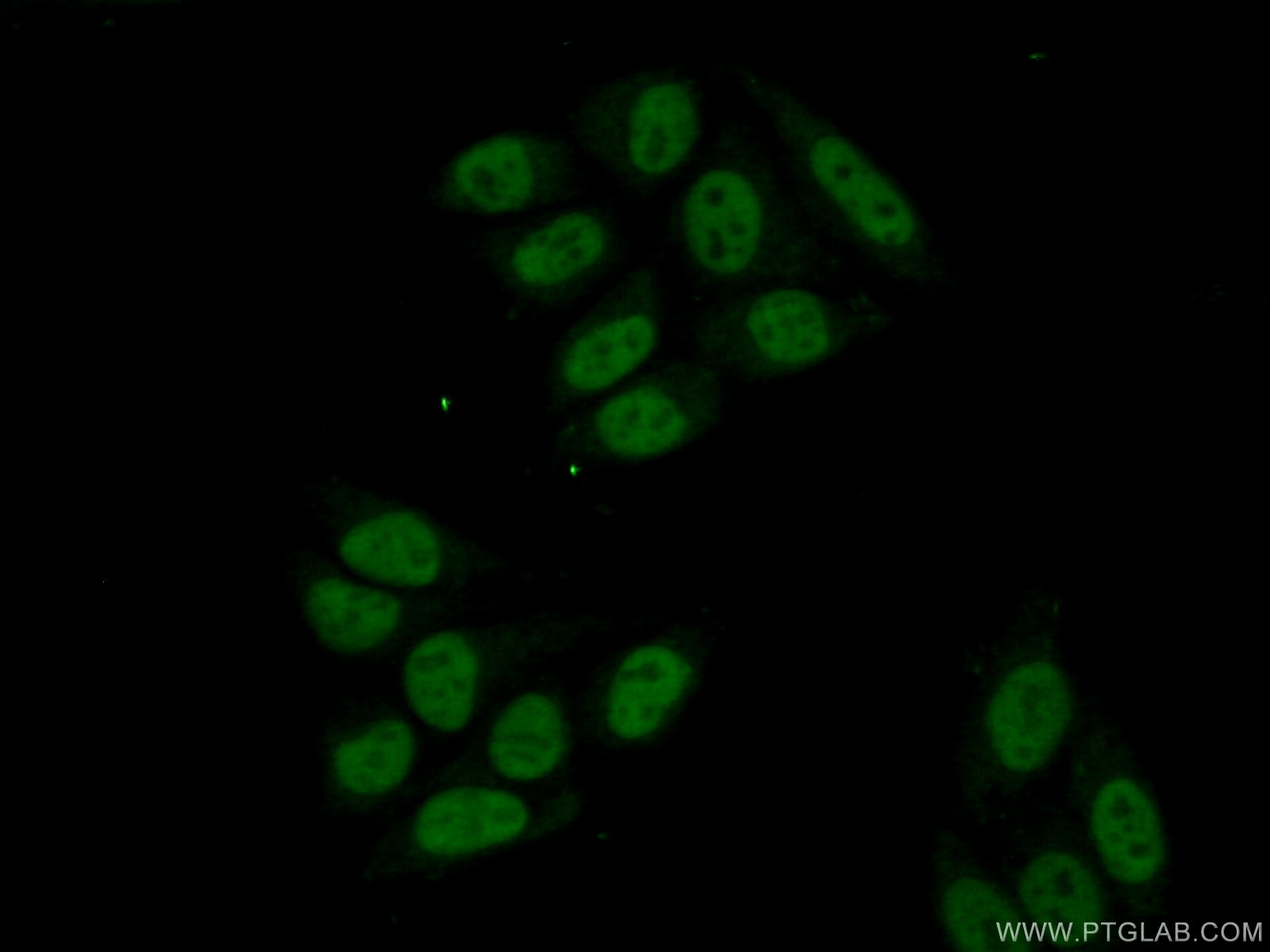 Immunofluorescence (IF) / fluorescent staining of HepG2 cells using ZCCHC8 Polyclonal antibody (23374-1-AP)