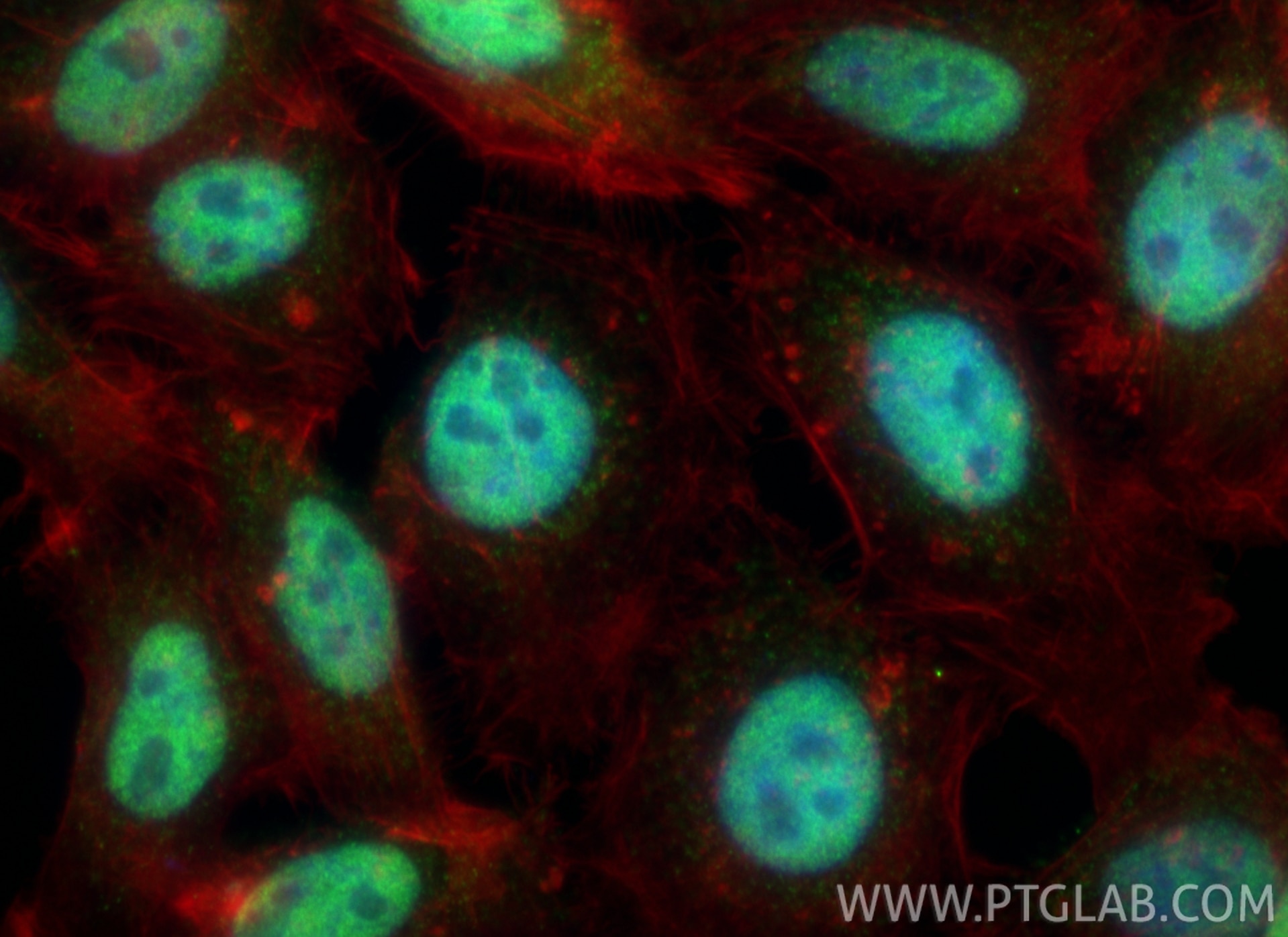 Immunofluorescence (IF) / fluorescent staining of HepG2 cells using ZCCHC8 Polyclonal antibody (23374-1-AP)