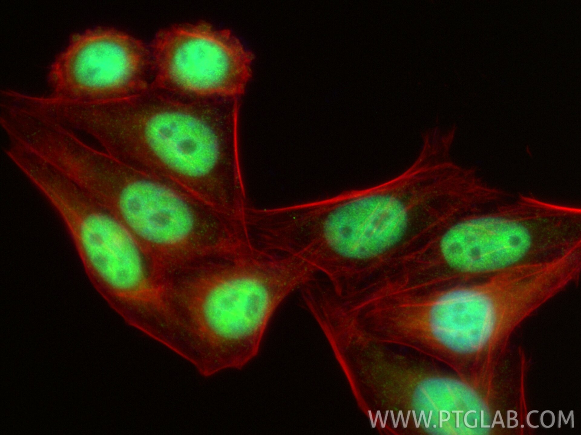 ZCCHC8 antibody (23374-1-AP) | Proteintech