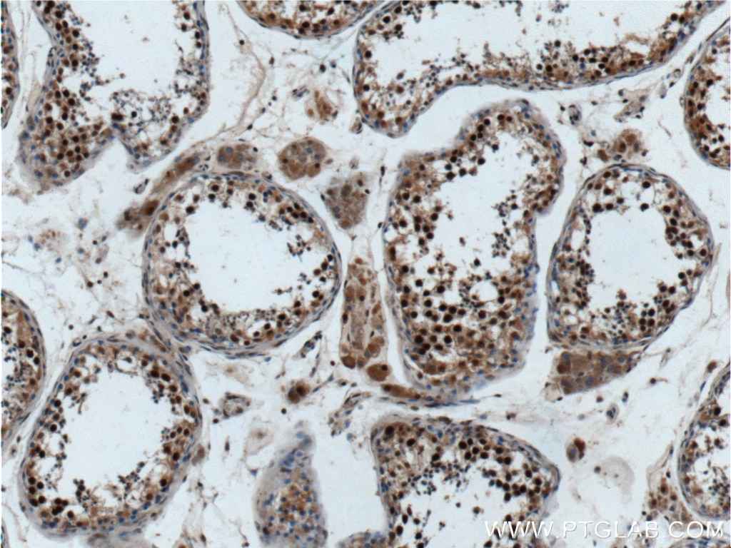 Immunohistochemistry (IHC) staining of human testis tissue using ZCCHC8 Polyclonal antibody (23374-1-AP)