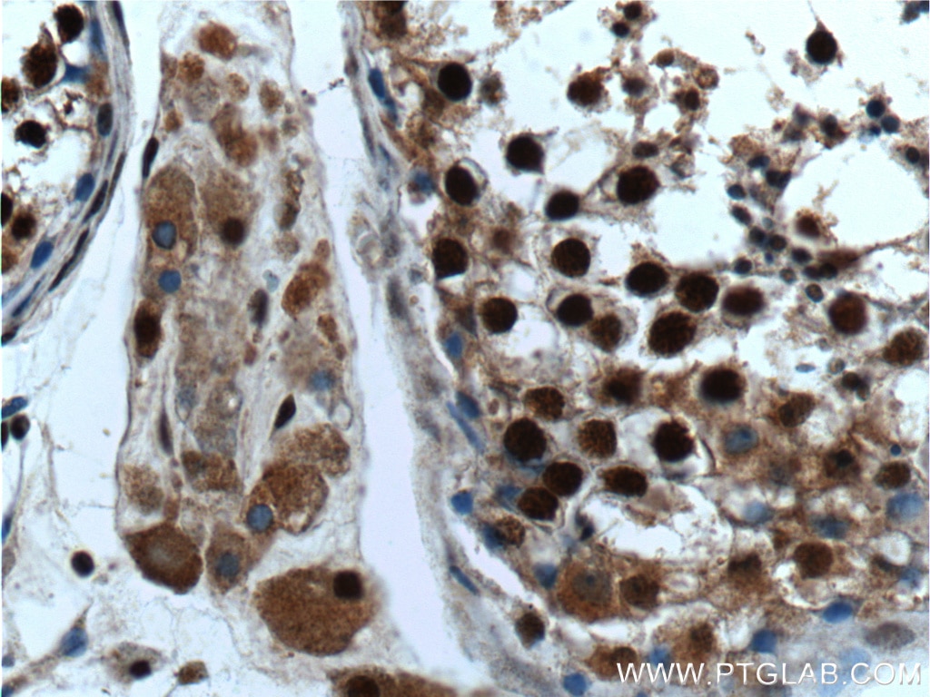 IHC staining of human testis using 23374-1-AP