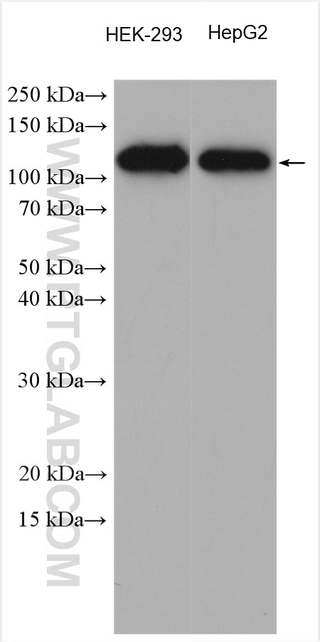 Western Blot (WB) analysis of various lysates using ZCCHC8 Polyclonal antibody (23374-1-AP)