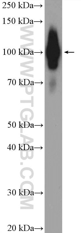 Western Blot (WB) analysis of mouse thymus tissue using ZCCHC8 Polyclonal antibody (23374-1-AP)