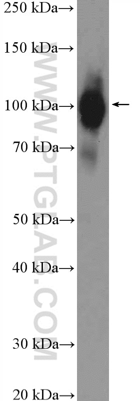 Western Blot (WB) analysis of mouse thymus tissue using ZCCHC8 Polyclonal antibody (23374-1-AP)