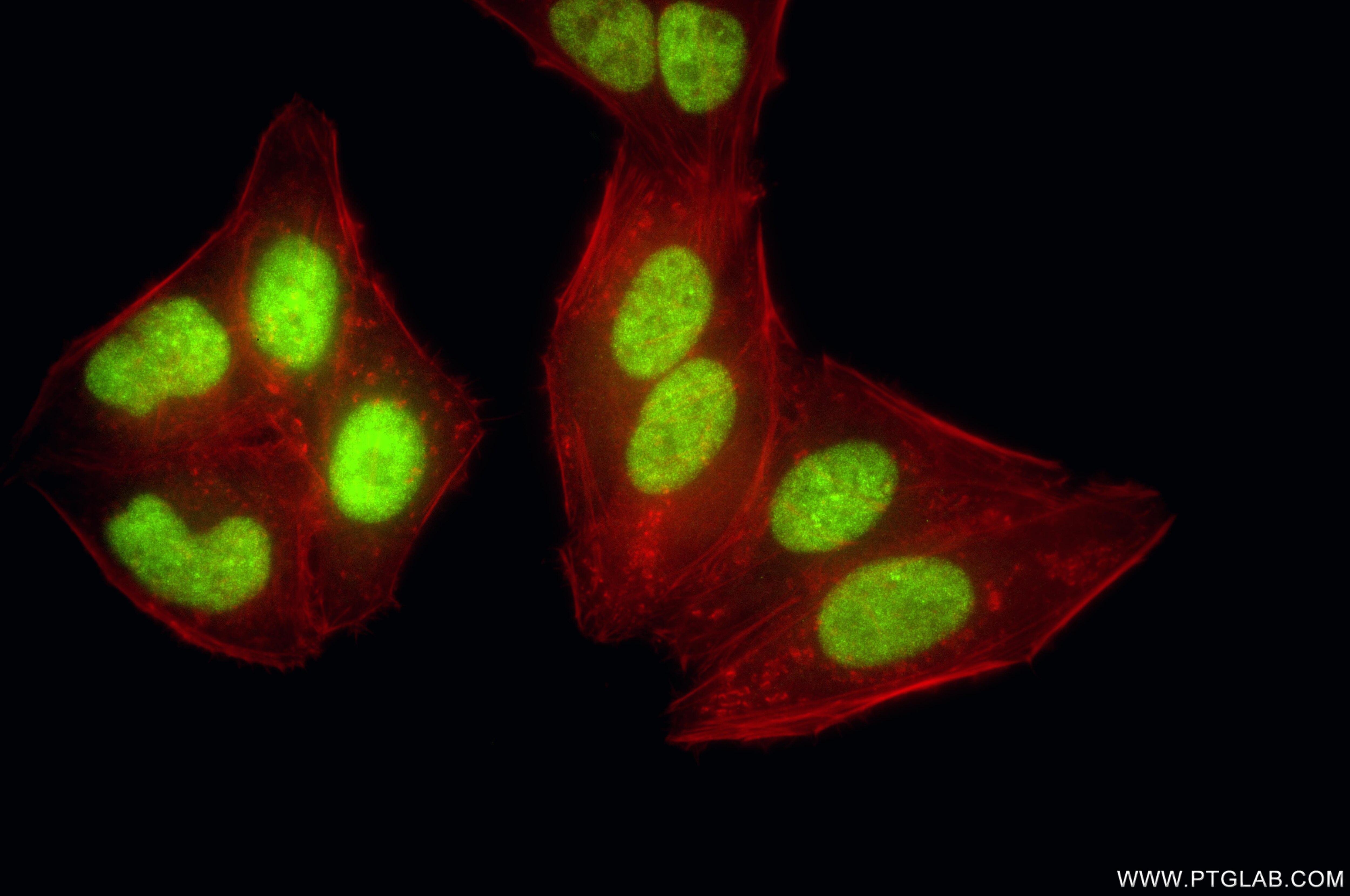 Immunofluorescence (IF) / fluorescent staining of HepG2 cells using ZCCHC8 Recombinant monoclonal antibody (87017-1-RR)