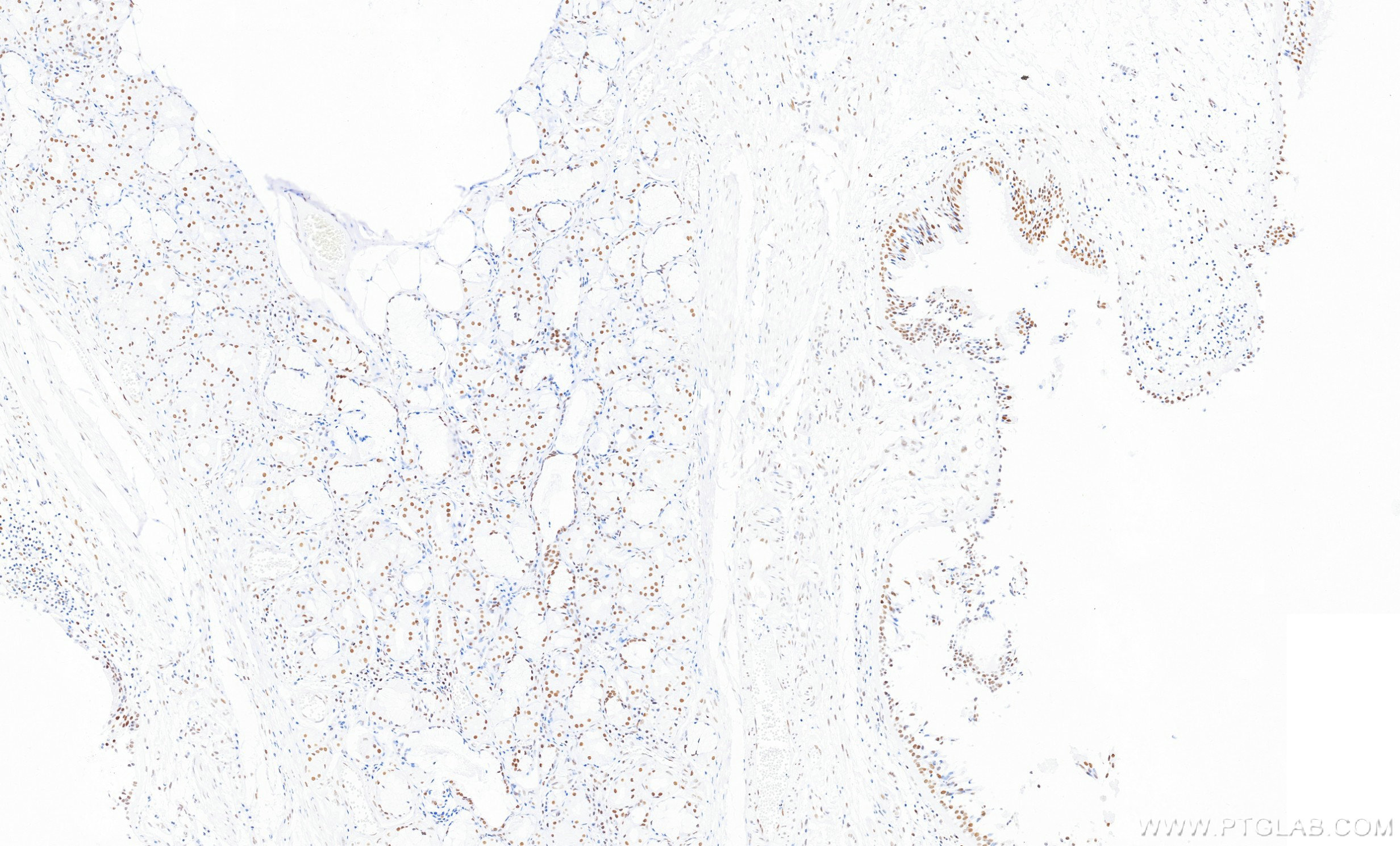 Immunohistochemistry (IHC) staining of human lung tissue using ZCCHC8 Recombinant monoclonal antibody (87017-1-RR)