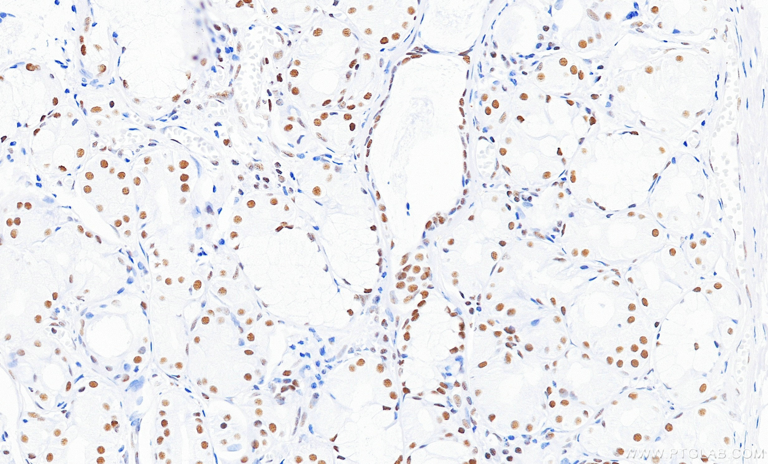 Immunohistochemistry (IHC) staining of human lung tissue using ZCCHC8 Recombinant monoclonal antibody (87017-1-RR)