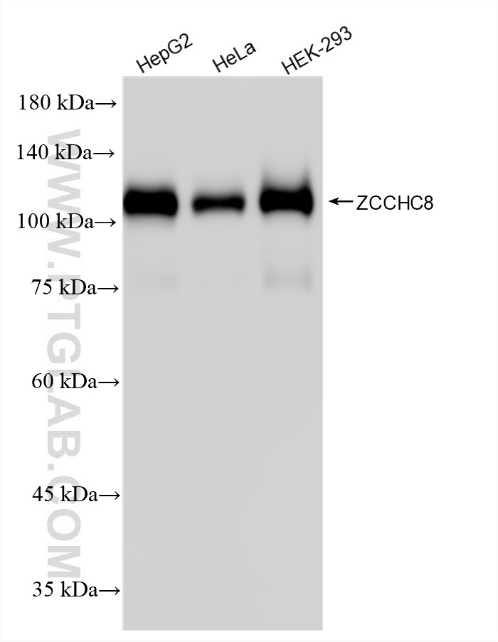 Western Blot (WB) analysis of various lysates using ZCCHC8 Recombinant monoclonal antibody (87017-1-RR)