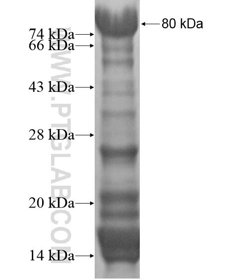 ZCCHC8 fusion protein Ag19985 SDS-PAGE