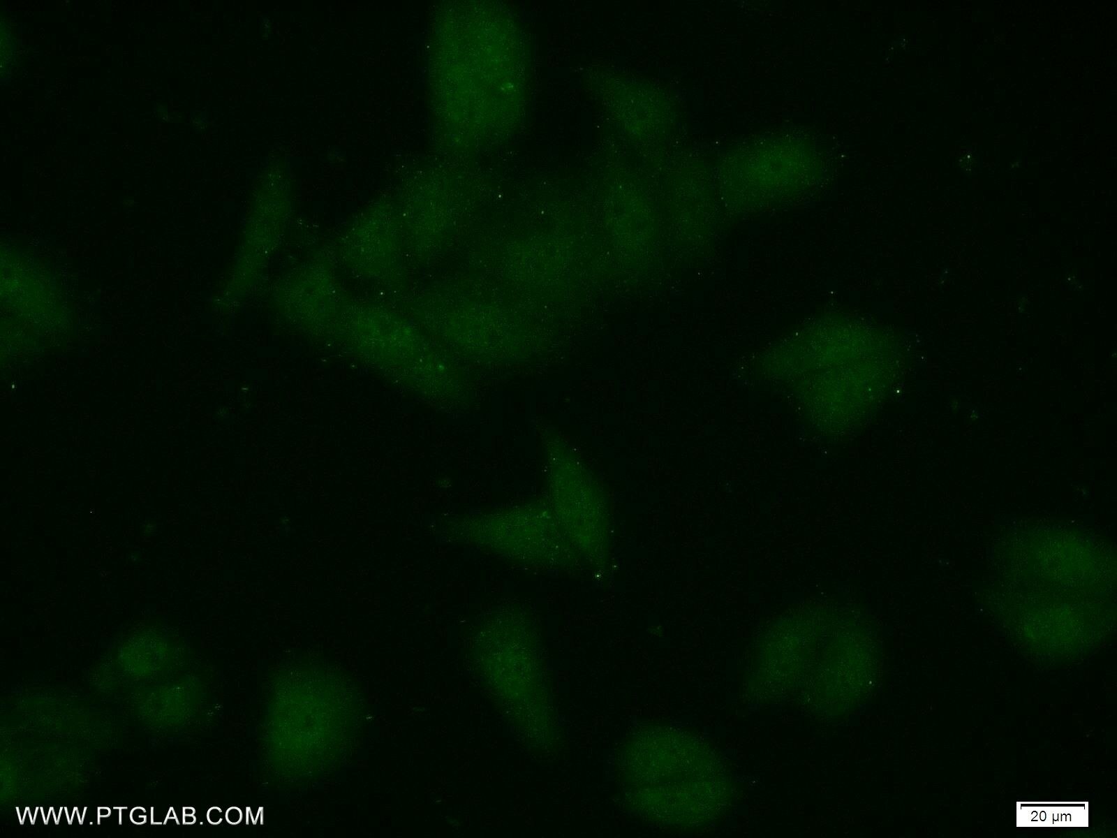 Immunofluorescence (IF) / fluorescent staining of HepG2 cells using ZCRB1 Polyclonal antibody (25629-1-AP)