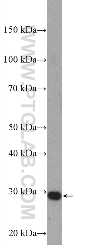 Western Blot (WB) analysis of Raji cells using ZCRB1 Polyclonal antibody (25629-1-AP)