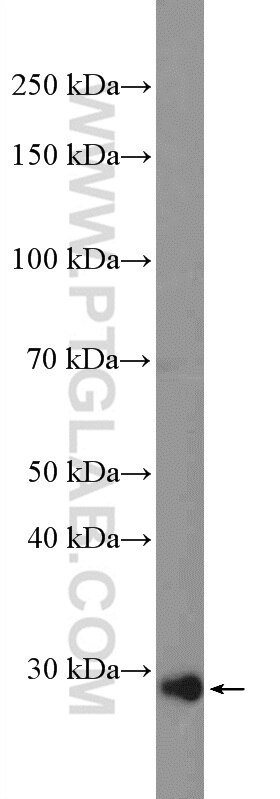 Western Blot (WB) analysis of mouse testis tissue using ZCRB1 Polyclonal antibody (25629-1-AP)