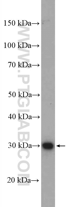 Western Blot (WB) analysis of Neuro-2a cells using ZCRB1 Polyclonal antibody (25629-1-AP)