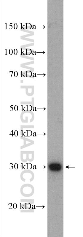 Western Blot (WB) analysis of Neuro-2a cells using ZCRB1 Polyclonal antibody (25629-1-AP)