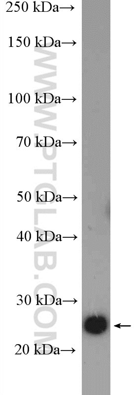 Western Blot (WB) analysis of Raji cells using ZCRB1 Polyclonal antibody (25629-1-AP)