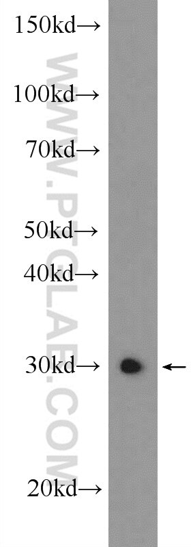 Western Blot (WB) analysis of mouse testis tissue using ZCRB1 Polyclonal antibody (25629-1-AP)