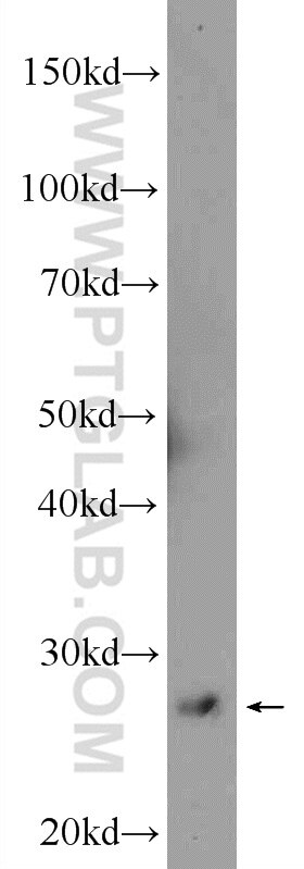 Western Blot (WB) analysis of SMMC-7721 cells using ZCRB1 Polyclonal antibody (25629-1-AP)