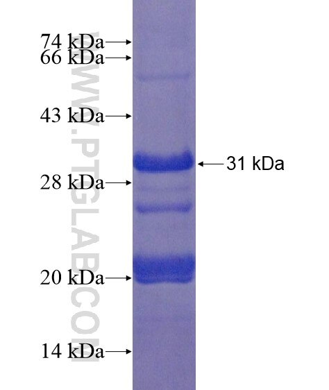 ZCRB1 fusion protein Ag22095 SDS-PAGE