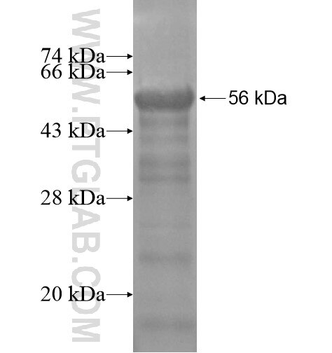 ZCWPW1 fusion protein Ag14832 SDS-PAGE